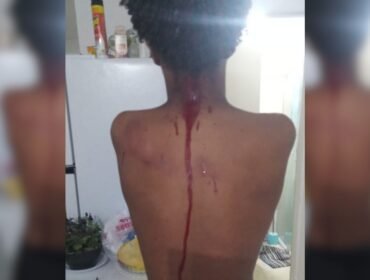 Adolescente com TEA se machuca em desafio viral em condomínio no bairro do Portão