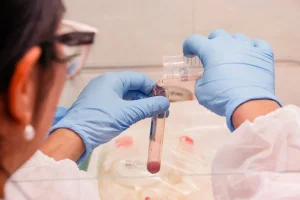 Exame de Sangue com IA Revoluciona Diagnóstico da Hanseníase: Detecta Doença em Estágio Inicial e Assintomático