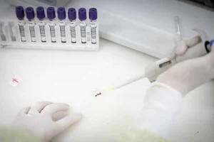 Ebola em SP: Homem com sintomas é isolado e saúde pública mantém vigilância máxima no estado