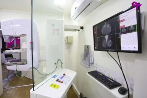 Carretas de Mamografia Grátis: 10 Cidades Paulistas Recebem Exames Gratuitos em Agosto para Mulheres Acima de 35 Anos
