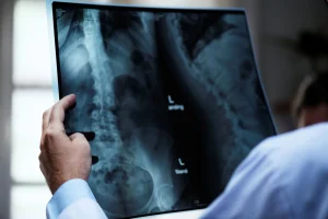 Osteoporose Silenciosa: Entenda Como a Doença Afeta Homens e Mulheres de Forma Distinta e Saiba os Cuidados Essenciais